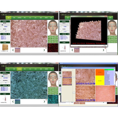 Instrument d'analyse de détection de peau CBS 5 mégapixels ultra précis
