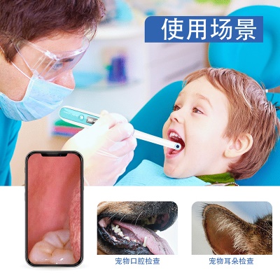 Inskam Stomatoscope endoscope HD connexion WiFi