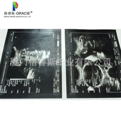 Papier d'impression thermosensible UPP-110S 110mm * 20m